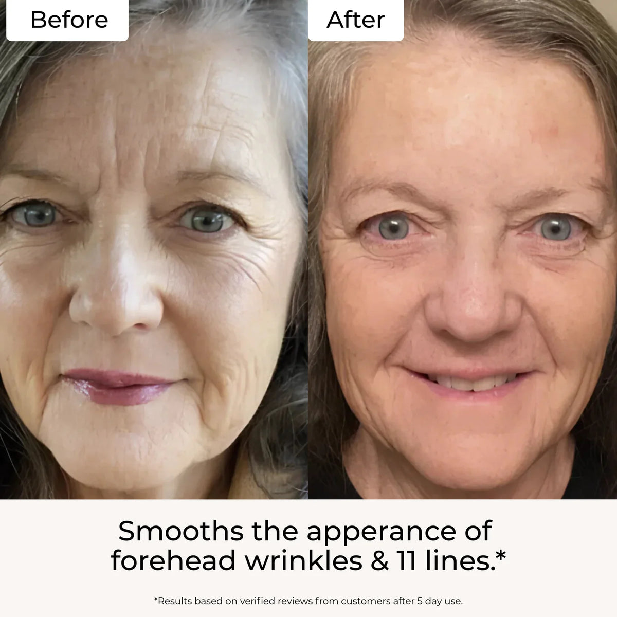 Targeted Fine Line Filler