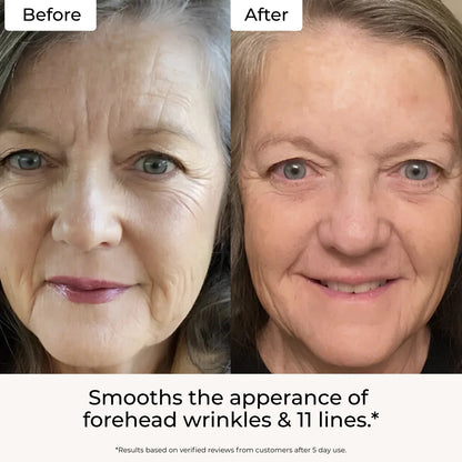 Targeted Fine Line Filler