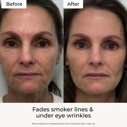 Targeted Fine Line Filler